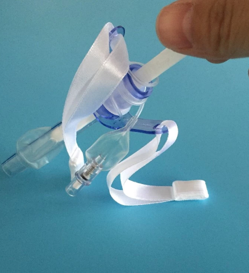 Tracheostomy Tube WithWith Cuff (2)